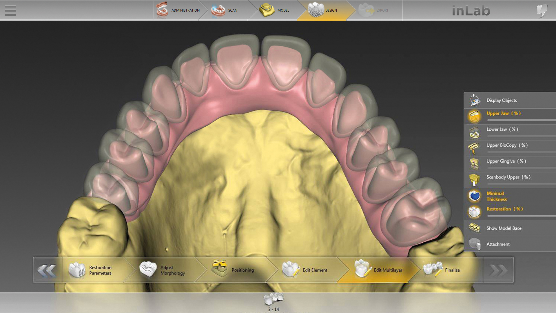 More indications, more functions - inLab SW update 18.0 enhances CAD ...