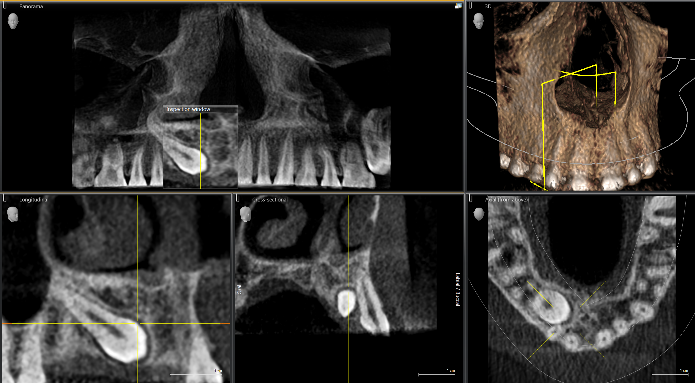 Orthophos SL Low Dose mode Indicationbased 3D Xray technology with